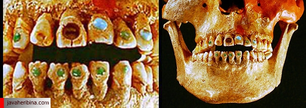 ۰۹۰۵۱۸-jeweled-teeth-picture_big
