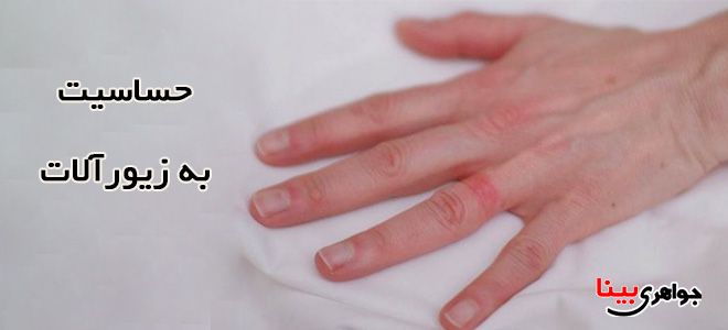 حساسیت به جواهرات